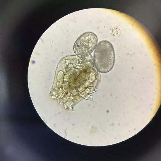 Rotifer Brachionus Calyciflorus Pallas Eggs Live Fish Food for Fry 