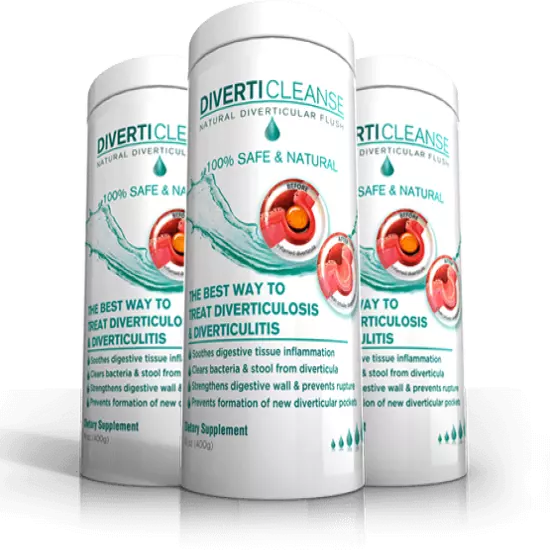 Diverticulitis and Diverticulosis Relief. Cleanse your diverticular pouches